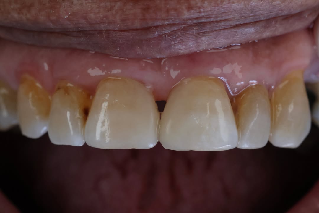 Après — Cas clinique 1